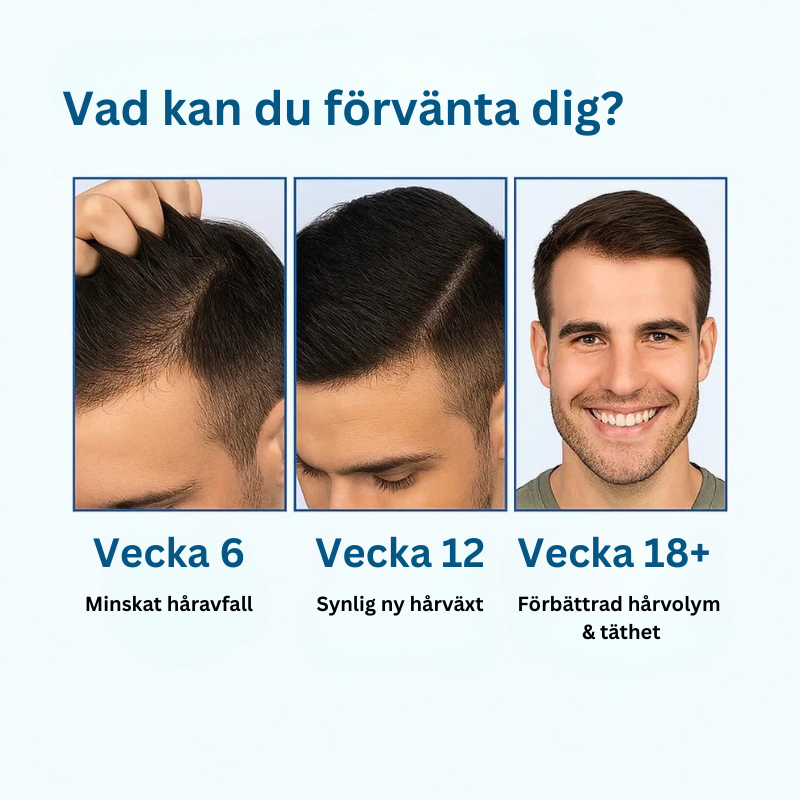 RootAura™ – Få Tillbaka Ditt Tjocka Hår